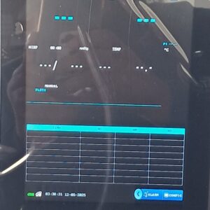 vital signs monitor-E8 8 inch monitor
