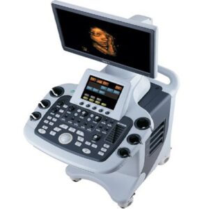 Alternative view of Apogee 3300 Digital 4D Color Doppler Ultrasound