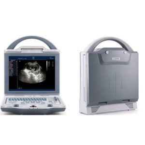 Alternative view of Rechargeable Human Ultrasound Scanner -KX5600